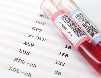 迅速検査により、当日診断・治療開始が可能